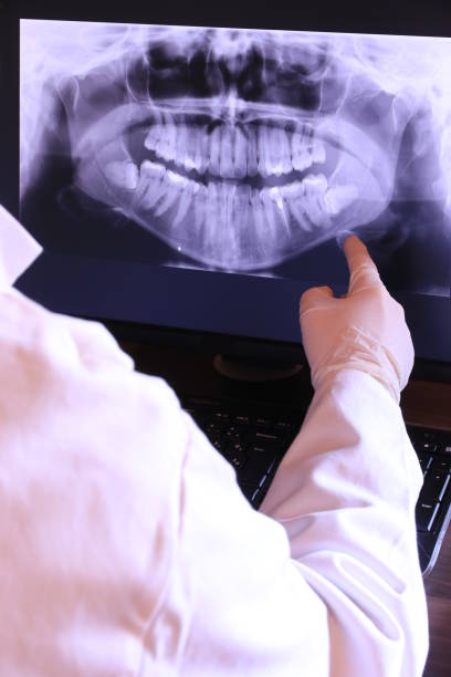 Best Emergency Root Canal Treatment in Corralitos, CA