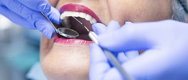 Best Urgent Care for Lost Fillings or Crowns in Corralitos, CA